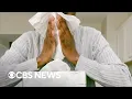 How allergies and weather changes could trigger a migraine