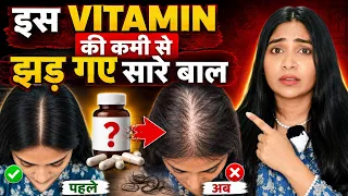 90% लोग नहीं जानते- Ek Vitamin से- झड़ रहे है आपके घने बाल, रुक गयी है Growth, ख़त्म हो रही है Density