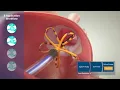 Deep Dive into FARAPULSE PFA System Workflow Animation