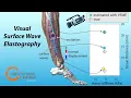 Visual Surface Wave Elastography ICCV 2025