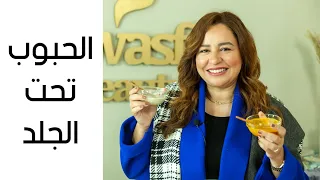 Solutions For Pimples Under The Skin 