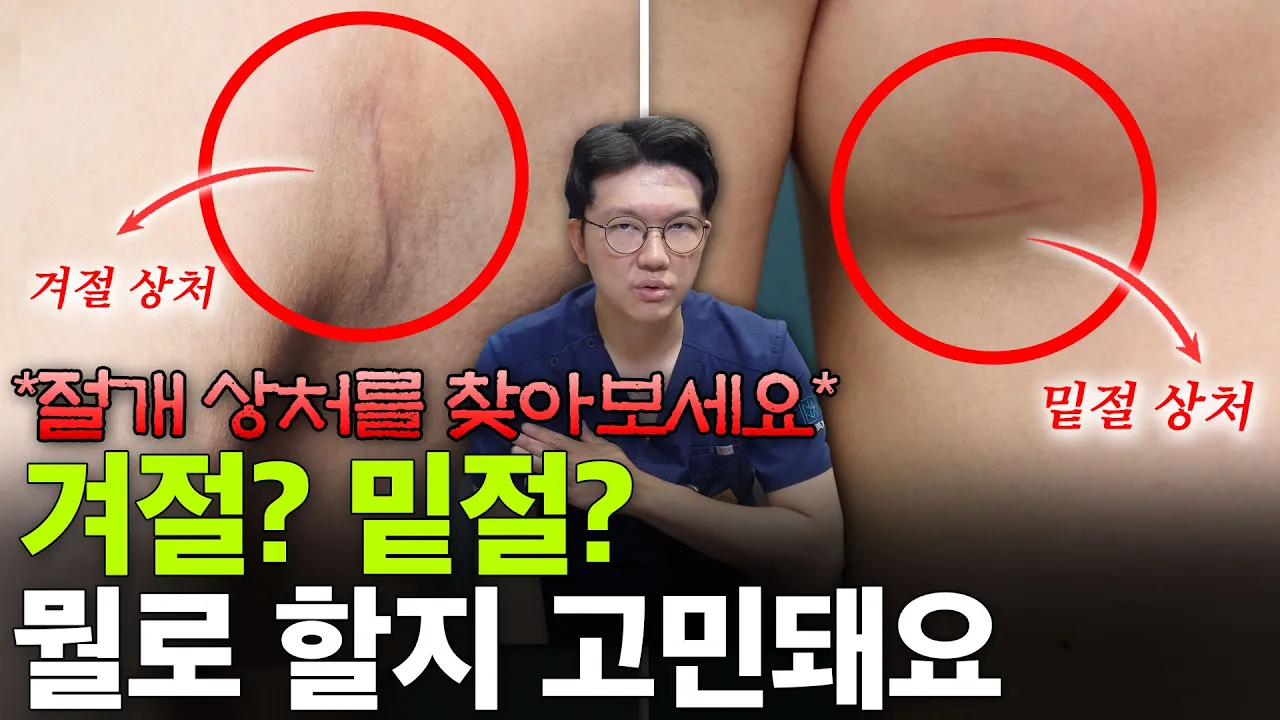 가슴수술 겨절 vs 밑선, 흉터가 덜 보이는 '진짜' 기준은? - 나에게 맞는 절개법 찾기