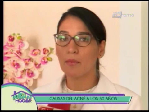 Causas del acné a los 30 años