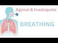 Agonal Breathing Demonstrated