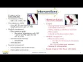 UCD Stroke Med Tele Skills Checklist presentation