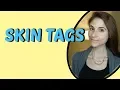 SKIN TAG REMOVAL Q A WITH DERMATOLOGIST DR DRAY