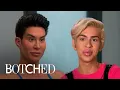 Real Life Barbie Ken Fix Botched Surgeries Botched E