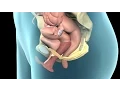 Pelvic Prolapse Nucleus Health