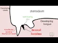 Development of Tooth - Part 1 Morphological stages