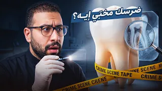 أخطر مرحلة في تسوس الأسنان! | Smile Expertez Clinics