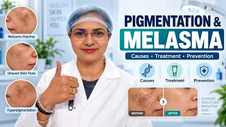 Pigmentation/ Melasma Kaise Thik Karen? Cosmetologist Suggestion