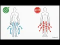 Quiet Spine: Dead Bug Progressions for Sciatica Relief