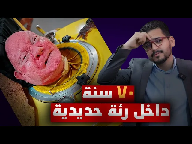 ⁣#الله_شمنطيني😒 بعد هذا الفيديو راح تحمد الله مليون مرة