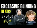 Excessive Eye Blinking in Children Causes Signs Treatment in