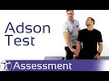 Download Lagu Adsontest | Thoracic Outlet Syndroom (TOS)