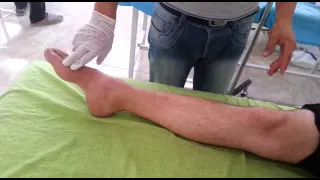 تمارين لتقوية عضلات الساق مركز أوبين            دندنها