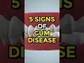 Lagu 5 Signs of Gum Disease #gumdisease #ytshorts