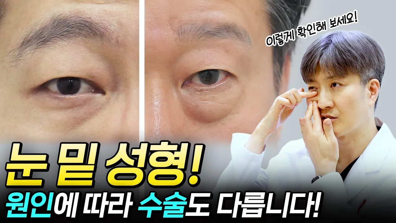 하안검? 눈밑지방재배치? 이것만 보고 결정하세요!
