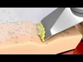 Ultrasonic Skin Spatula Cleansing | Ultrasonic Skin Scrubber Spatula | Blackhead Removal Exfoliation