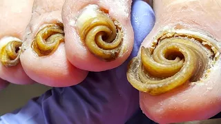 Charity Pedicure - Help The Elderly In Nursing Homes To Get A Pedicure!【Xue Yidao】
