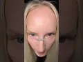Download Lagu Big forehead, hump nose And thin lips are normal ❤️#bigforehead #nose #thinlips #standards #shorts
