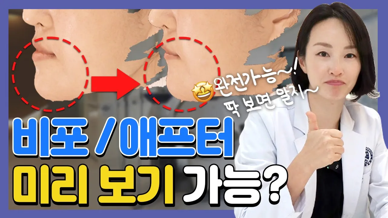 ()치아교정 후 내 얼굴을 미리 볼 수 있다면? 교정전에 꼭 확인해보세요!