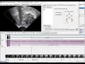 AAA219 manually tracking movement of a feature using a fiducial spline