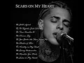 Anxiety in My Chest