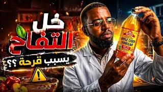 هل خل التفاح يسبب قرحة   دندنها