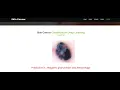 Skin Cancer Prediction Using Deep Learning Techniques Python Machine Learning IEEE Project