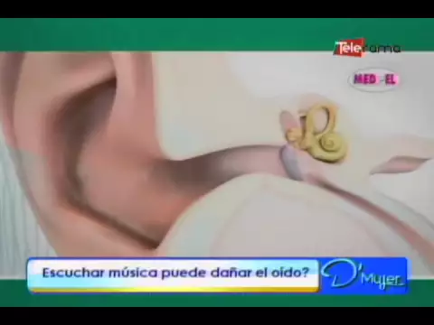 ¿Escuchar música puede dañar al oído?