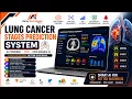 Lung Cancer Stages Prediction System Deep Learning CNN Explainable AI