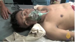 مؤثر جريح من المقاومة اليمنية أنا مديون حتى لفظ أنفاسه الأخيرة 