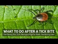 What to Do After a Tick Bite - Johns Hopkins Lyme Disease Research Center