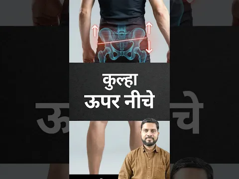Uneven Hips Exercises In Hindi #physiovedicclinic #hips #knee