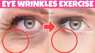 Download Eye Wrinkle Exercise! How To Remove Eye Wrinkles, Eye Bags, Dark Circles | Anti-Aging Eye Exercises MP3