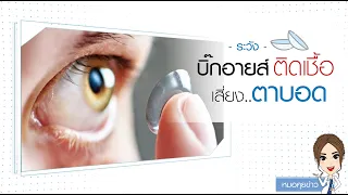 การใส่คอนแทคเลนส์แล้วไม่ดูแลความสะอาดอาจนำไปสู่โรคอะไรได้บ้าง 