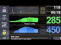 Quest Medical MPS 3 Series Combined Overview