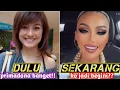 Download Lagu MENGEJUTKAN⁉️ PERUBAHAN WAJAH AGNEZ MO DI TAHUN 2024