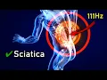 Download Lagu IT'S HERE ❯❯❯ The Sciatica \