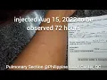 MY PPD TEST PURIFIED PROTEIN DERIVATIVE SKIN TEST LATENT TUBERCULOSIS SILENT TUBERCULOSIS