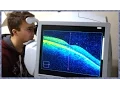 What is OCT Scanning Optical Coherence Tomography