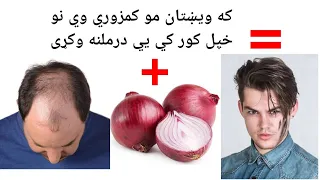 ويښتانو ته د پيازو ګټي د ويښتانو تويدلو درملنه په کور کي وکړی 