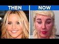 Download Lagu From Beautiful to Unrecognizable… Shocking Celebrity Transformations!
