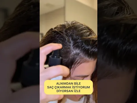 ALNIMDAN BİLE SAÇ ÇIKARSIN DEDİN VE ÇIKARDI #trending #shortvideo #trend