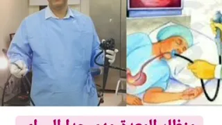 منظار المعدة 