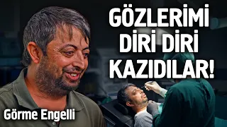 Gözlerimi Diri Diri Kazıdılar! - Görme Engelli