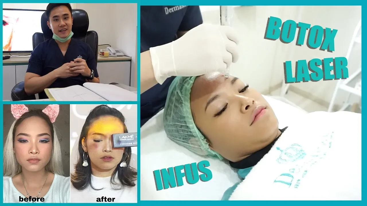 
          
          
          
            
            BOTOX DAN TREATMENT DI DERMASTER (+ HARGANYA) | Amyra Irzanti
          
        . 