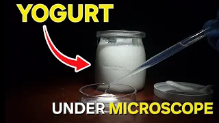 Homemade Yogurt Under Microscope