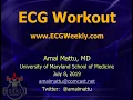 Benign early repol vs. STEMI